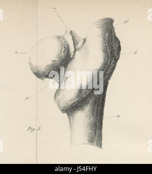 Image prise à partir de la page 468 de "remarques pratiques sur la nature et le traitement des fractures du tronc et des extrémités, etc' Banque D'Images