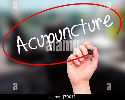 La main de l'homme écrit l'Acupuncture avec marqueur noir sur l'écran visuel. Isolé sur fond. Le commerce, la technologie, internet concept. Stock Photo Banque D'Images