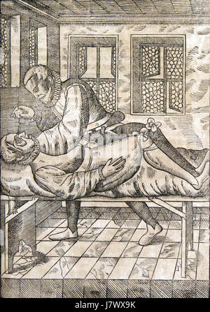 Il s'agit d'une illustration ou d'une page manuscrite d'un texte médical du médecin allemand Felix Bartisch. L'œuvre, qui date du XVIe siècle, est connue pour ses représentations détaillées de l'anatomie oculaire et des pratiques chirurgicales. Banque D'Images