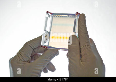 Mains tenant l'électrophorèse en gel, agarophose montrant différentes bandes de couleur de teinture de marquage des indicateurs de déplacement les molécules d'ADN par le gel Banque D'Images