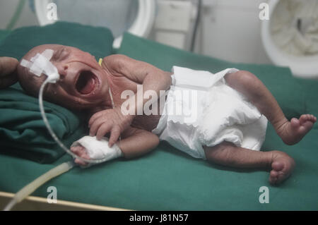 Dhaka, Bangladesh. 27 mai, 2017. Un bébé est né au Bangladesh Medical College Hospital il y a 4 jours avec une maladie génétique très rare appelée Progeria. Cet enfant progresse depuis sa naissance. Les médecins disent ; son poids de naissance était seulement.86 kg. Les enfants souffrant de cette maladie, apparaissent comme un très vieil homme. Leur processus de vieillissement est 8 fois plus rapide qu'un enfant normal.Hutchinson Gilbert Progeria Syndrome est appelé ce problème. En quelques millions, 1 enfant est né. Le prédécesseur est appelé vieillissement rapide. Fondamentalement, en raison d'un problème génétique, cet environnement est vu. Il n'y a pas de cause spécifique trouvé o Banque D'Images