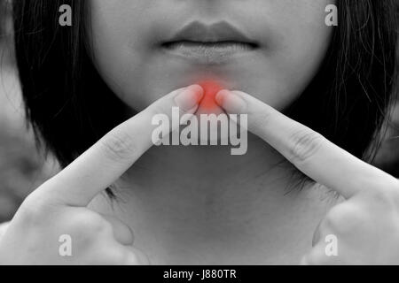 Jeune femme serrer l'acné sur le menton, point rouge de l'acné. Banque D'Images