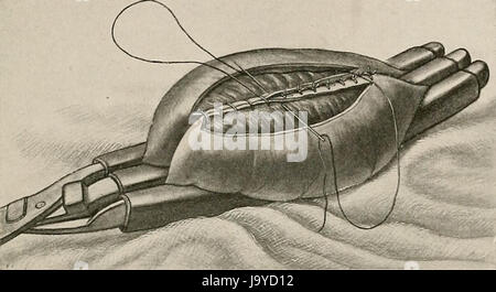 'Surgery, ses principes et pratique" (1906) Banque D'Images