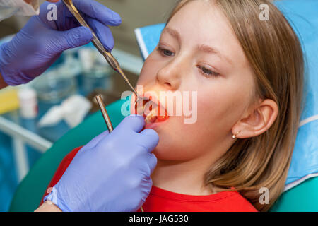 Stomatologie vérifie les dents jusqu'à un enfant, fille sur une réception en stomatologie Banque D'Images