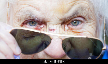 Close up photo d'un femme âgée de mettre ses lunettes de soleil pour masquer les blessures Banque D'Images