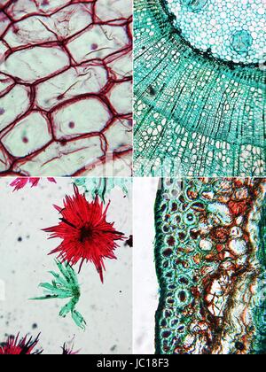 Light photomicrographie de cellules d'oignon rouge (en haut à gauche), pomme fruit (en bas à gauche) et de pins bois section (à droite) vu à travers un microscope Banque D'Images
