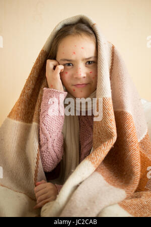 Portrait de petite fille avec démangeaisons varicelle Banque D'Images