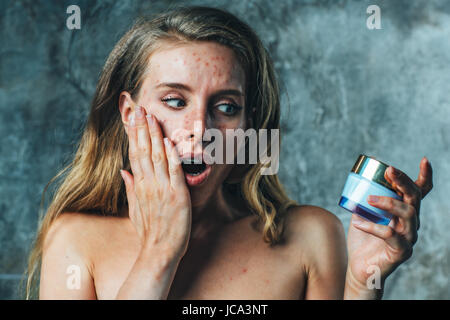 Jeune femme ont sur l'allergie à la crème corps. Son visage ont beaucoup d'acné et elle est très malheureuse. Banque D'Images