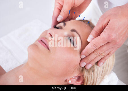 Détail d'une femme qui reçoit une aiguille d'Acupuncture Therapy Banque D'Images