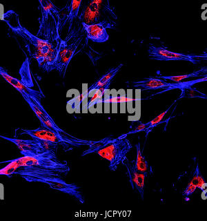 L'imagerie confocale immunofluorescence des cellules de mélanome Banque D'Images