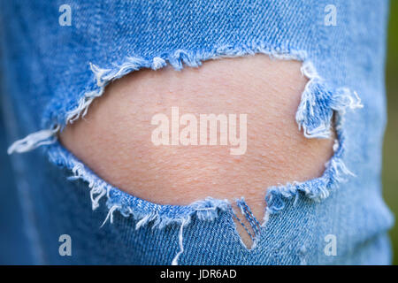 Close up photo d'une femme de jeans déchirés sur sa jambe Banque D'Images