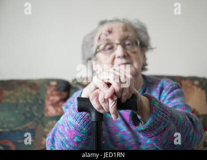 90 ans dame avec blessure à la tête de la récupération à la suite de sa propre maison à l'hôpital après l'orthographe tomber dans sa propre chambre. Banque D'Images