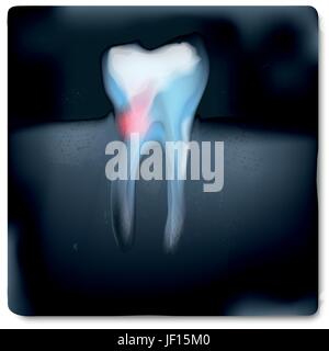 La radiographie avec dent et de dents Illustration de Vecteur