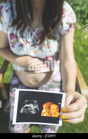 Les femmes enceintes image en attente d'utérus Banque D'Images