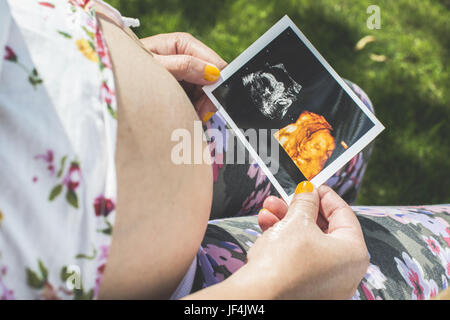 Les femmes enceintes image en attente d'utérus Banque D'Images