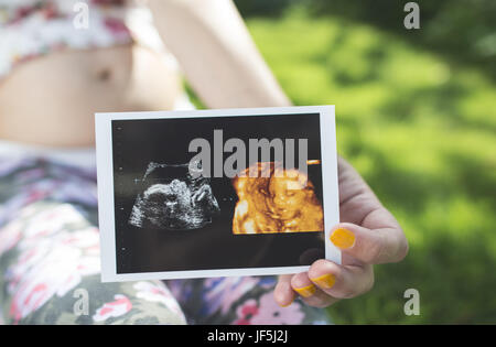 Les femmes enceintes image en attente d'utérus Banque D'Images