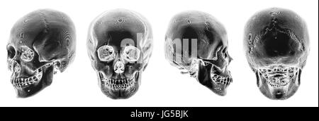 Scanner 3D de crâne humain . Plusieurs avis . Style couleur Inverser . Banque D'Images