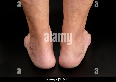 Tendon d’Achille Banque D'Images