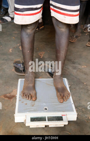 Kiryangondo camp de réfugiés. Le programme de prévention de la malnutrition dirigé par préoccupation dans le monde entier. L'Ouganda. Banque D'Images