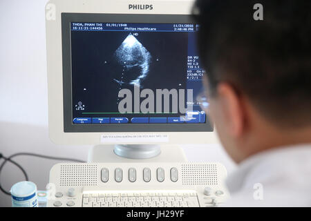 Tam Duc Heart Hospital. Échocardiographie Doppler. Ho Chi Minh Ville. Le Vietnam. Banque D'Images