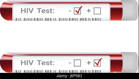 Résultat du test de dépistage du VIH avec tube de prélèvement sanguin Concept vih indiquant les résultats des tests positifs et négatifs isolé sur un fond blanc. Vector Illustration réaliste. Illustration de Vecteur