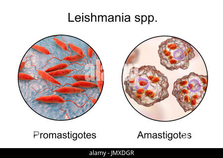 Promastigotes de Leishmania parasites amastigotes et à l'intérieur des macrophages, illustration. La leishmaniose à Leishmania sp. causer, une maladie tropicale transmise par les piqûres de mouches infectées-sable. Ce sont les flagelles sous forme de promastigote le parasite. Chez les humains le flagellé promastigotes phase infecte les macrophages et sont transformés dans le stade amastigote non-flagellé. Il y a deux formes de la leishmaniose. La première, la leishmaniose cutanée, affecte la peau donnant lieu à un ulcère à l'emplacement de la morsure. Ce guérit principalement, bien que naturellement la cicatrisation peut se produire. Le plus grave, Banque D'Images