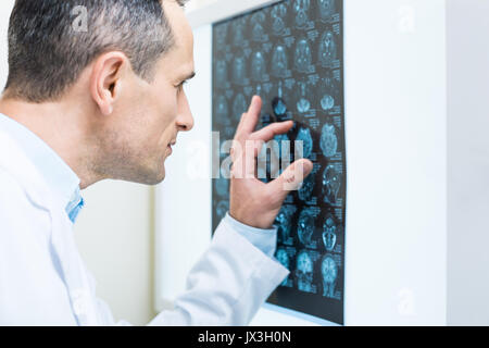 Close up de médecin l'analyse des résultats de la tomographie assistée par ordinateur Banque D'Images