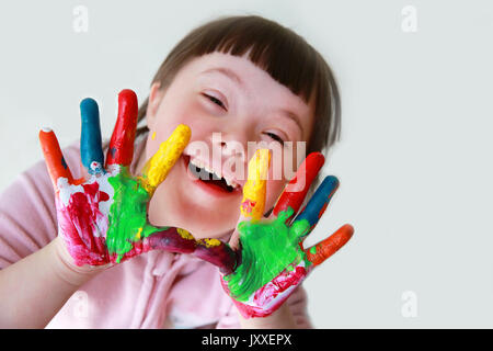 Jolie petite fille avec le syndrome de mains peintes. Banque D'Images