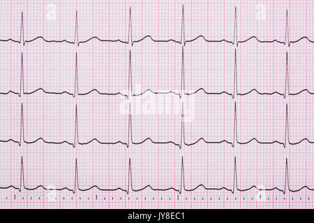 Close up d'un électrocardiographe également connu sous le nom d'un graphique ou d'ECG EKG Banque D'Images