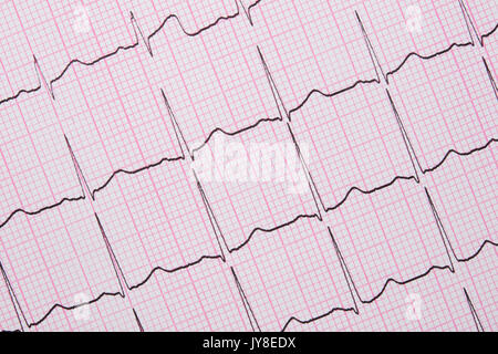 Close up d'un électrocardiographe également connu sous le nom d'un graphique ou d'ECG EKG Banque D'Images