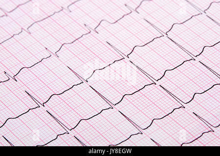 Close up d'un électrocardiographe également connu sous le nom d'un graphique ou d'ECG EKG Banque D'Images