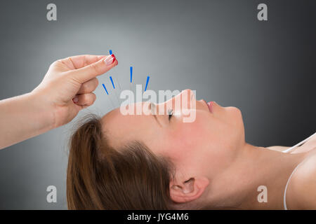 Close-up personne mains mettre aiguille d'Acupuncture sur le visage de jeune femme Banque D'Images