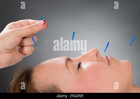 Close-up personne mains mettre aiguille d'Acupuncture sur le visage de jeune femme Banque D'Images