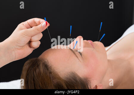 Close-up personne mains mettre aiguille d'Acupuncture sur le visage de jeune femme Banque D'Images