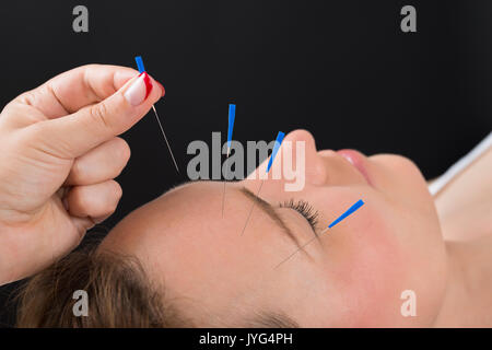 Close-up personne mains mettre aiguille d'Acupuncture sur le visage de jeune femme Banque D'Images