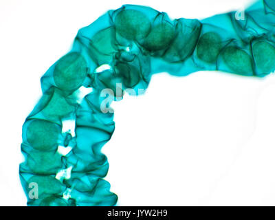 Champ lumineux lumière Microphotographie d'un filament vert algue Spirogyra sur un prêt de microscope, illustré est d'environ 850 micromètres de large Banque D'Images