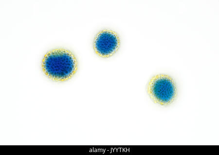 Grains de pollen (spores) à partir d'un échantillon d'air, tachés de bleu de méthyle, fond clair light micrograph, la taille de chaque particule 17-22 micromètres Banque D'Images