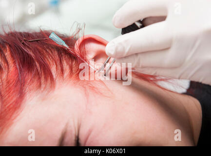 La préhension professionnel Piercing oreille de la peau après l'insertion de la canule. Type tragus Banque D'Images