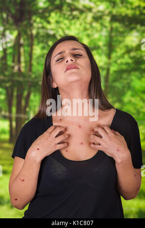 Jeune femme portant un chemisier noir et souffrant de démangeaisons après les piqûres de moustiques, dans un flou fond vert Banque D'Images