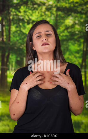 Jeune femme portant un chemisier noir et souffrant de démangeaisons après les piqûres de moustiques, dans un flou fond vert Banque D'Images