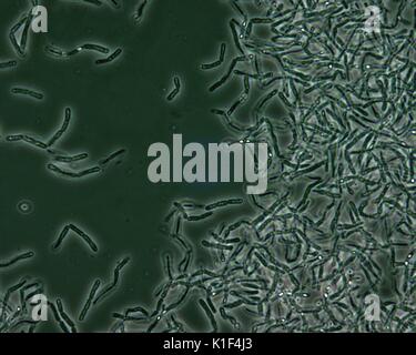 Les spores de Bacillus anthracis vu sous un microscope à contraste de phase. Les endospores Bacillus anthracis sont vus sous un microscope à contraste de phase que les zones plus claires, c'est-à-dire aux "points de lumière", en raison du fait qu'ils sont déshydratés, et par conséquent, plus réfringent. Image courtoisie CDC/avec la permission de Larry Stauffer, Laboratoire de santé publique de l'état de l'Oregon, 2002. Banque D'Images