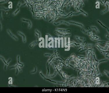 Les spores de Bacillus anthracis vu sous un microscope à contraste de phase. Les endospores Bacillus anthracis sont vus sous un microscope à contraste de phase que les zones plus claires, c'est-à-dire aux "points de lumière", en raison du fait qu'ils sont déshydratés, et par conséquent, plus réfringent. Image courtoisie CDC/avec la permission de Larry Stauffer, Laboratoire de santé publique de l'état de l'Oregon, 2002. Banque D'Images