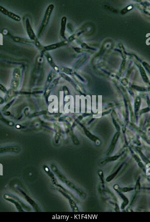 Les spores de Bacillus anthracis vu sous un microscope à contraste de phase. Les endospores Bacillus anthracis sont vus sous un microscope à contraste de phase que les zones plus claires, c'est-à-dire aux "points de lumière", en raison du fait qu'ils sont déshydratés, et par conséquent, plus réfringent. Image courtoisie CDC/avec la permission de Larry Stauffer, Laboratoire de santé publique de l'état de l'Oregon, 2002. Banque D'Images