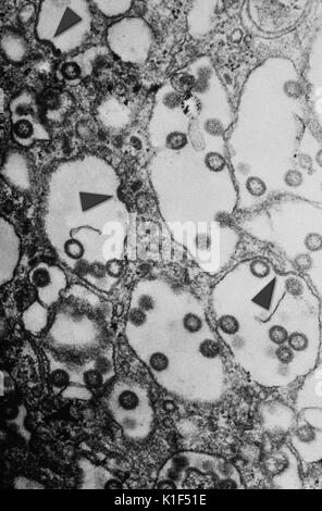 Sous un grossissement très élevé, cette micrographie électronique à transmission (MET) a révélé une partie de la morphologie ultrastructurale vu dans un échantillon de tissu inconnu, qui avait été causée par la forme sphérique, enveloppé de la vallée du Rift (FVR) virus. Dans cette vue vous pouvez voir certains en herbe à partir de virions la membrane cellulaire, indiqué par les flèches. La Vallée du Rift (FVR) est une maladie aiguë, fièvre - causant la maladie virale plus fréquemment observé dans les animaux domestiques (comme les bovins, buffles, ovins, caprins et camélidés), avec la capacité à infecter et causer la maladie chez les humains. La maladie est causée par le R Banque D'Images