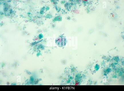 Amibe parasitaire (Entamoeba histolytica) dans le gros intestin, l