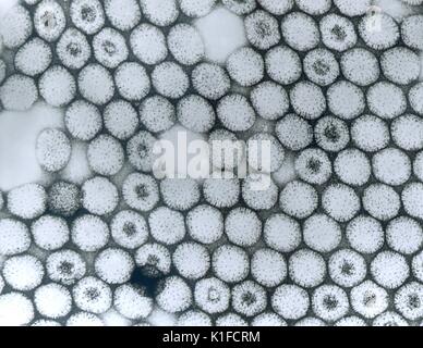 Cette micrographie électronique à transmission (TEM) décrit le nombre de virions réovirus type 3. Micrographe du réovirus de type 3. Les deux coquilles de la capside interne et externe sont présents. Les virions sont pénétrées par une tache négatif. Image courtoisie CDC/Dr. Erskine Palmer, 1981. Banque D'Images