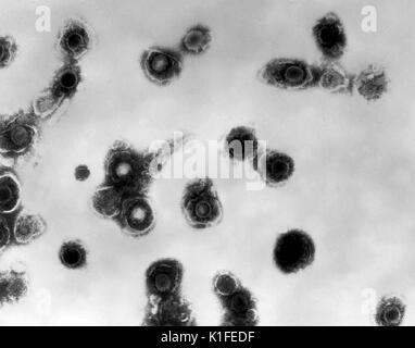 Micrographie électronique à transmission de virus varicelle-zona de liquide vésiculaire de patient avec la varicelle.. Image courtoisie CDC/Dr. Erskine Palmer., 1981. Banque D'Images