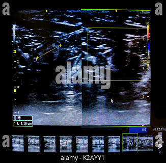 L'image colorée d'échographie modernes moniteur. Machine à échographie. La haute technologie de l'équipement médical et de soins de santé. D'une échographie ou sonogra Banque D'Images