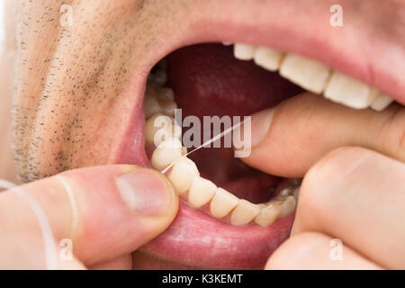 Photo en gros plan d'un homme de la soie dentaire dents Banque D'Images