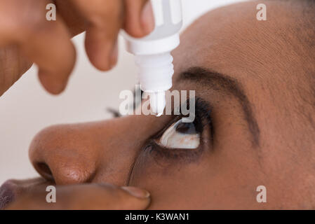 Close-up of Young African Woman Using eye Drop Banque D'Images